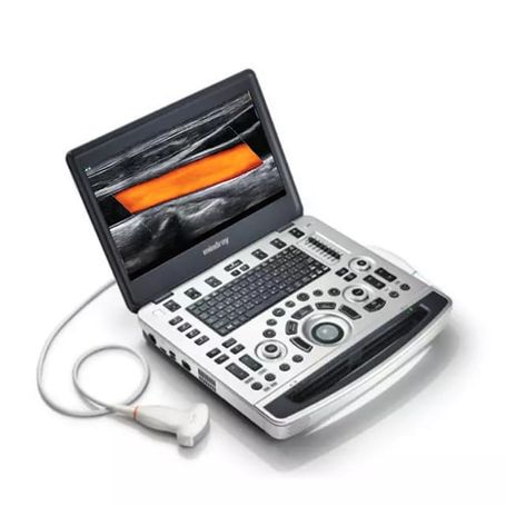 Portable Ultasound Scanner
