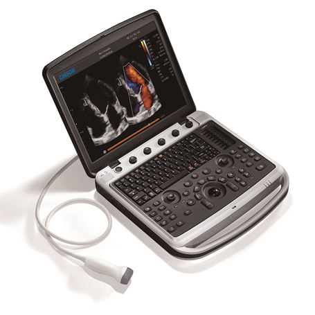 Portable Cardiology Ultrasound