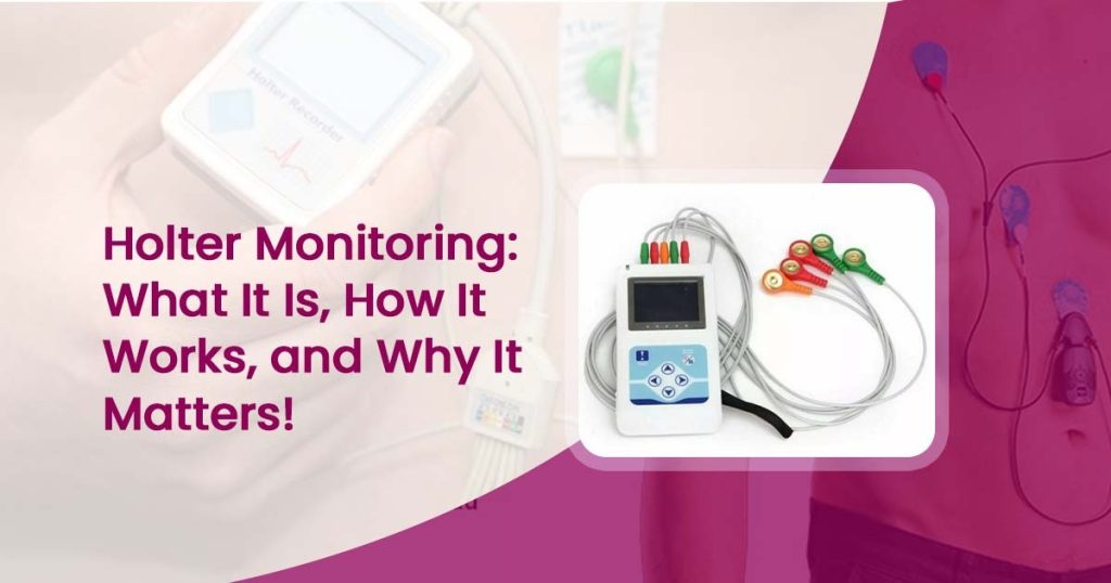Holter Monitoring: What It Is, How It Works, and Why It Matters